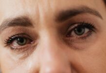 Dry Skin Under Eyes: Causes and How to Get Rid of Them Forever Dry skin around eyes