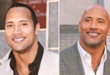 15 Famous Bald Celebrities When They Had Hair