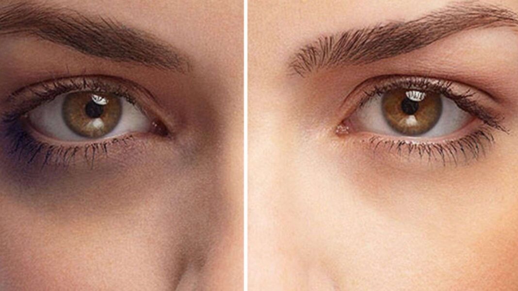 Banner Under Eye Creams for Dark Circles