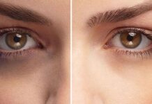 12 Under Eye Creams to Fade Dark Circles and Treat Puffiness Under Eye Creams for Dark Circles
